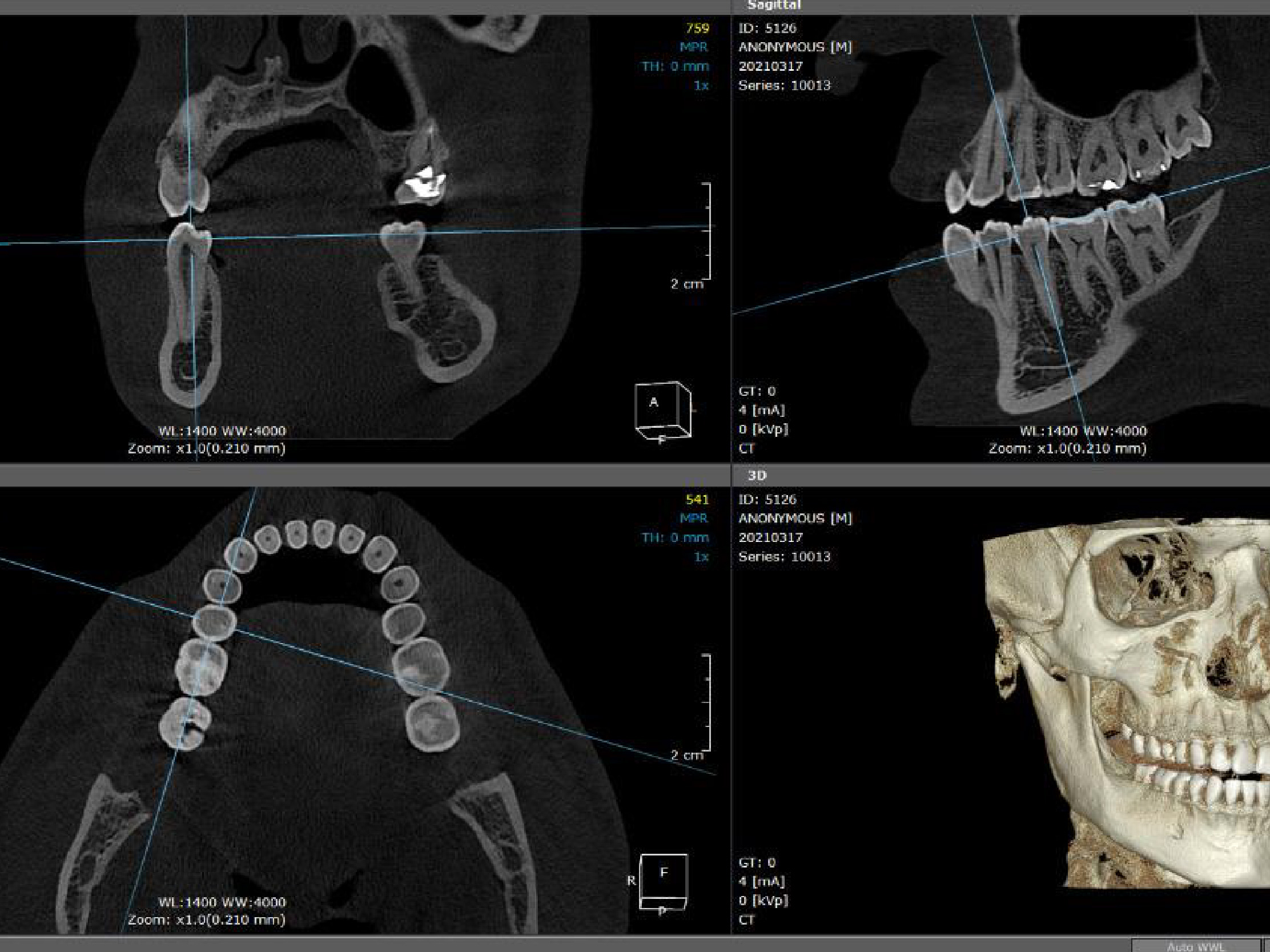 Reconstrucción Volumétrica